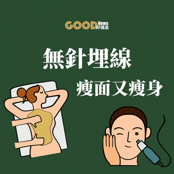 無針埋線療程幫你瘦面又瘦身